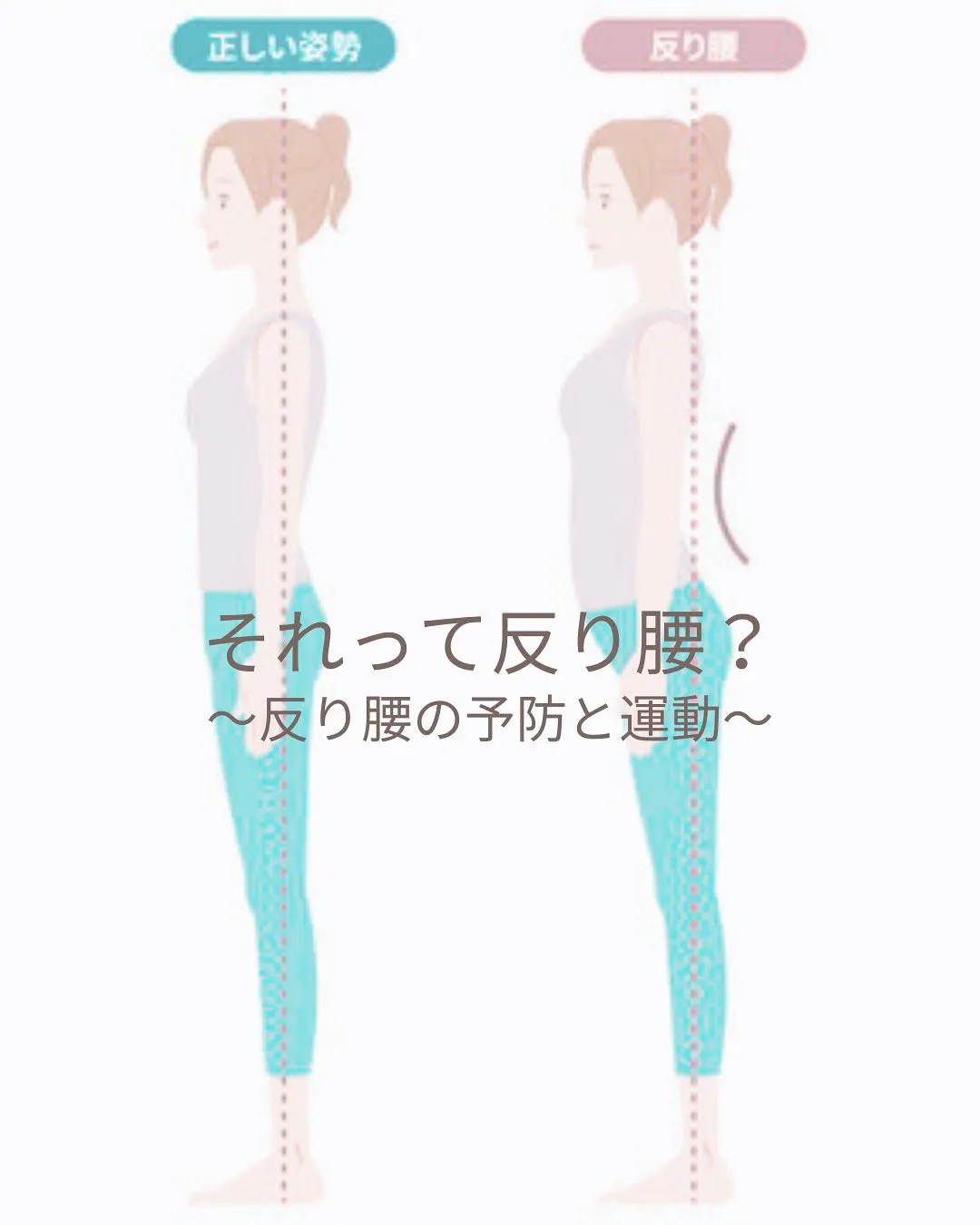 反り腰について